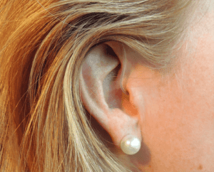 Xylo behind ear hearing aid