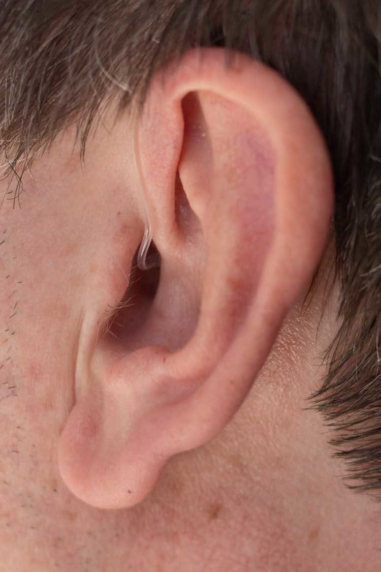 Evok hearing aid in the ear